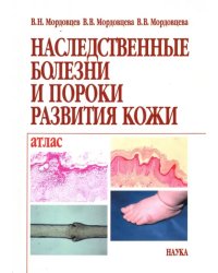 Наследственные болезни и пороки развития кожи. Атлас