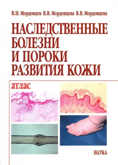 Наследственные болезни и пороки развития кожи. Атлас