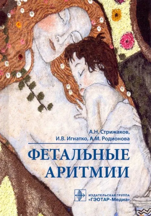 Обложка книги «Фетальные аритмии» — Стрижаков Александр Николаевич, Игнатко Ирина Владимировна, Родионова Александра Михайловна, ISBN 9785970463703