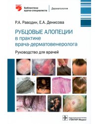 Рубцовые алопеции в практике врача-дерматовенеролога. Руководство для врачей