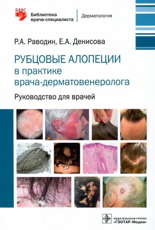 Библиотека врача-специалиста Рубцовые алопеции в практике врача-дерматовенеролога. Руководство для врачей