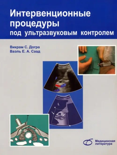Обложка книги «Интервенционные процедуры под ультразвуковым контролем» — Догра Викрэм, Монзер Абу-Юсеф, Браун Даниэль, ISBN 9785896771845