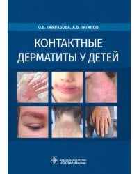 Контактные дерматиты у детей