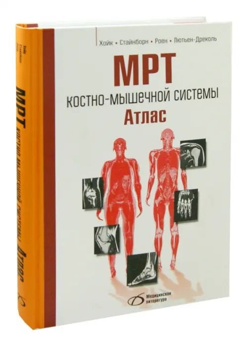 МРТ костно-мышечной системы. Атлас