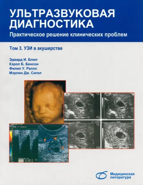 Ультразвуковая диагностика Ультразвуковая диагностика. Практическое решение клинических проблем. Том 3. УЗИ в акушерстве