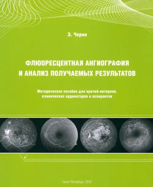 Флюоресцентная ангиография и анализ получаемых результатов. Методическое пособие для врачей-интернов