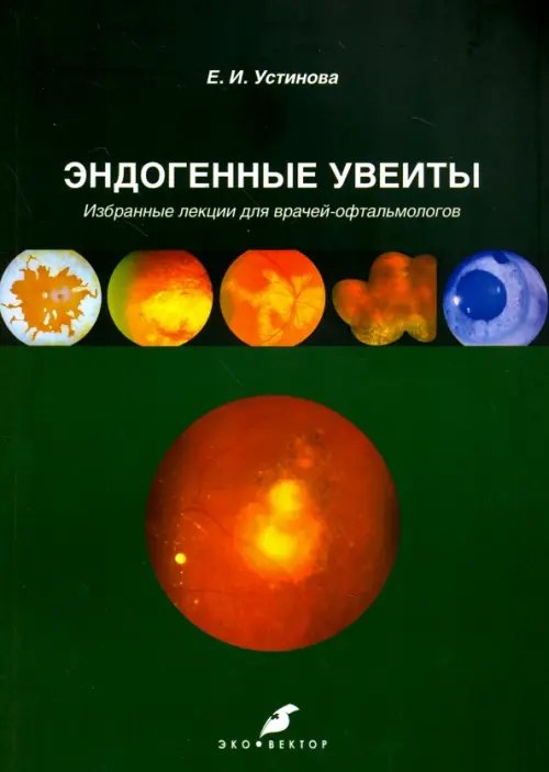 Эндогенные увеиты. Избранные лекции для врачей-офтальмологов