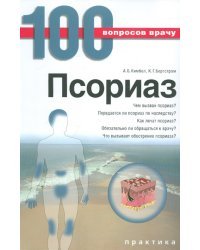 Псориаз