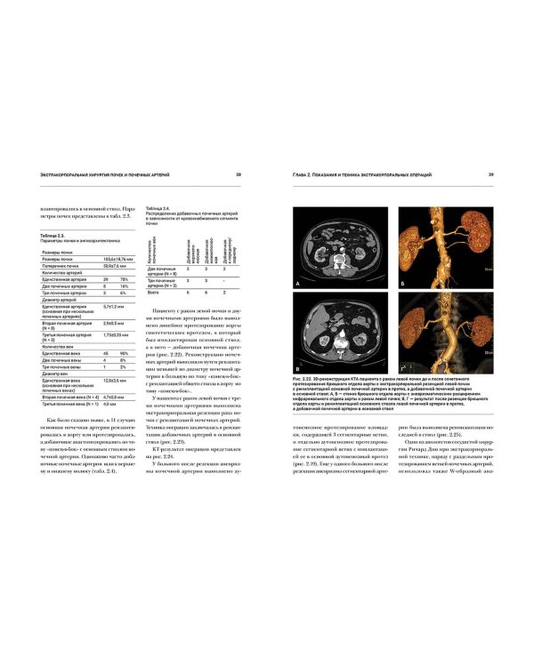 Экстракорпоральная хирургия почек и почечных артерий