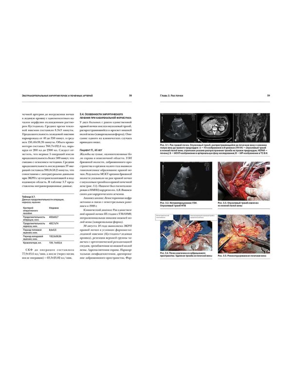 Экстракорпоральная хирургия почек и почечных артерий