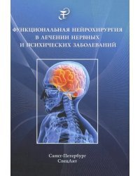 Функциональная нейрохирургия в лечении нервных заболеваний