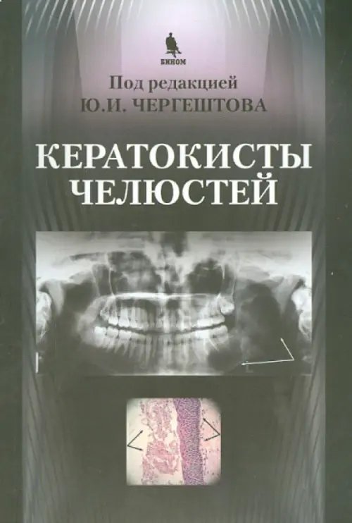Обложка книги «Кератокисты челюстей» — Чергештов Юрий Иосифович, ISBN 9785951804563