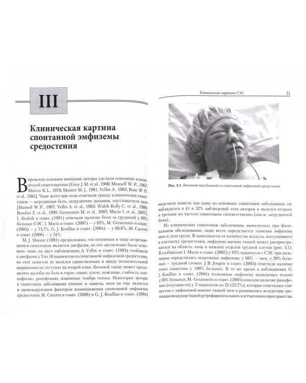 Дополнительное изображение книги «Спонтанная эмфизема средостения. Клиника, диагностика, лечение»