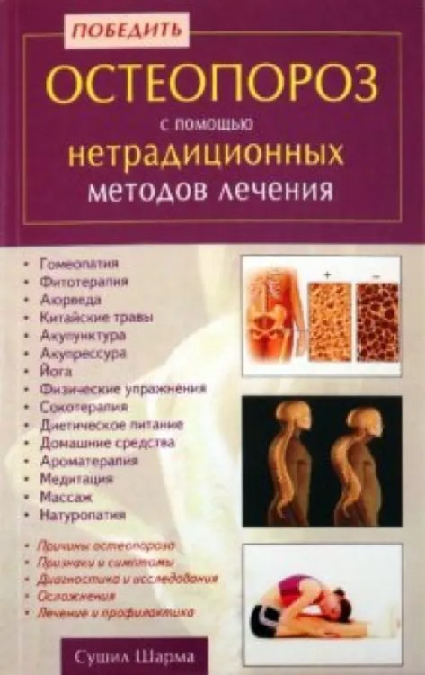 Обложка книги «Победить остеопороз с помощью нетрадиционных методов лечения» — Шарма Сушил, ISBN 9785885039826
