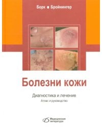 Болезни кожи. Диагностика и лечение. Атлас и руководство