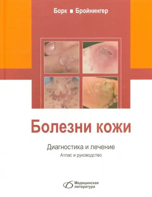 Болезни кожи. Диагностика и лечение. Атлас и руководство Болезни кожи. Диагностика и лечение. Атлас и руководство