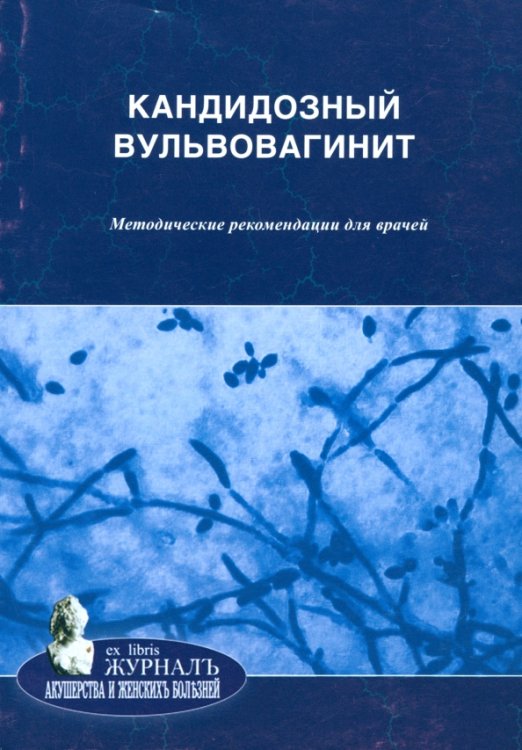 Ex Libris Журнал акушерства и женских болезней Кандидозный вульвовагинит. Методические рекомендации для врачей