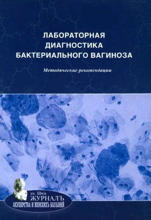Ex Libris Журнал акушерства и женских болезней Лабораторная диагностика бактериального вагиноза. Методические рекомендации