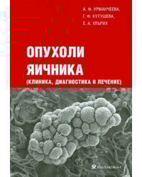 Опухоли яичника (клиника, диагностика и лечение)