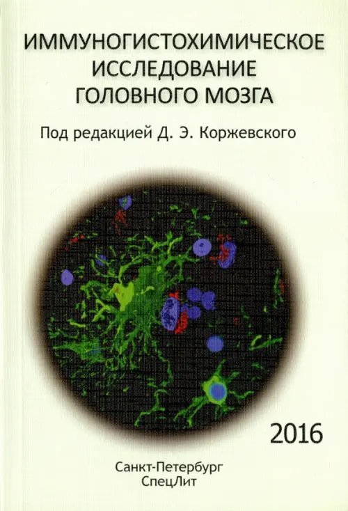 Иммуногистохимическое исследование головного мозга Иммуногистохимическое исследование головного мозга