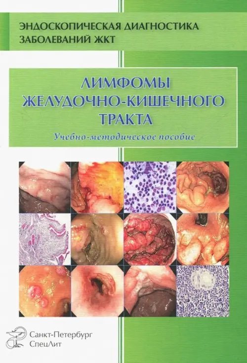 Лимфомы ЖКТ. Учебно-методическое пособие