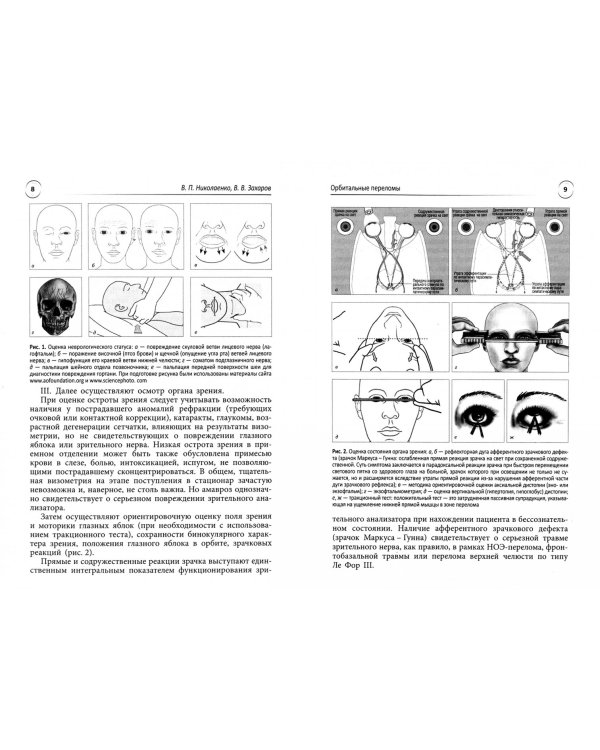 Орбитальные переломы. Учебно-методическое пособие