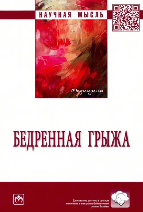 Бедренная грыжа. Монография