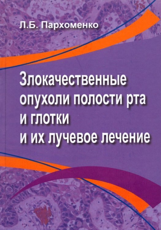 Злокачественные опухоли полости рта и глотки и их лучевое лечение Злокачественные опухоли полости рта и глотки и их лучевое лечение