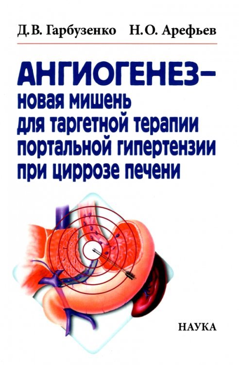 Ангиогенез - новая мишень для таргетной терапии портальной гипертензии при циррозе печени Ангиогенез - новая мишень для таргетной терапии портальной гипертензии при циррозе печени