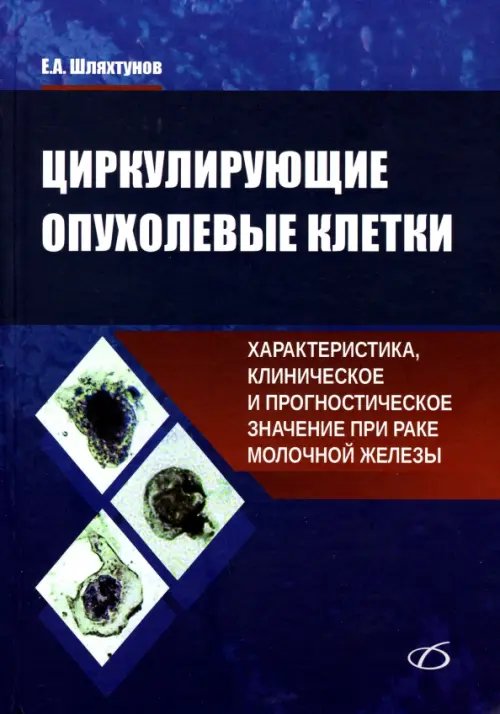 Обложка книги «Циркулирующие опухолевые клетки. Характеристика, клиническое и прогностическое значение при раке» — Шляхтунов Евгений Александрович, ISBN 9789856333630