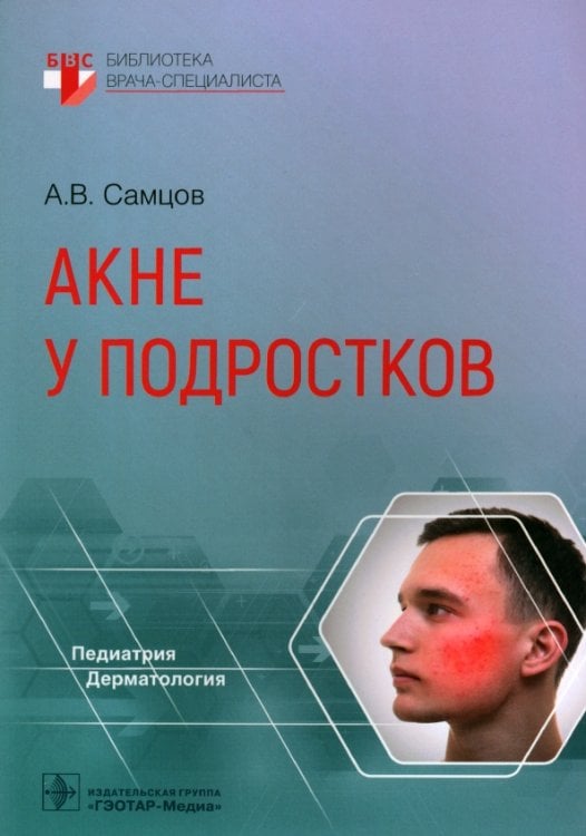 Обложка книги «Акне у подростков. Руководство» — Самцов Алексей Викторович, ISBN 9785970468326