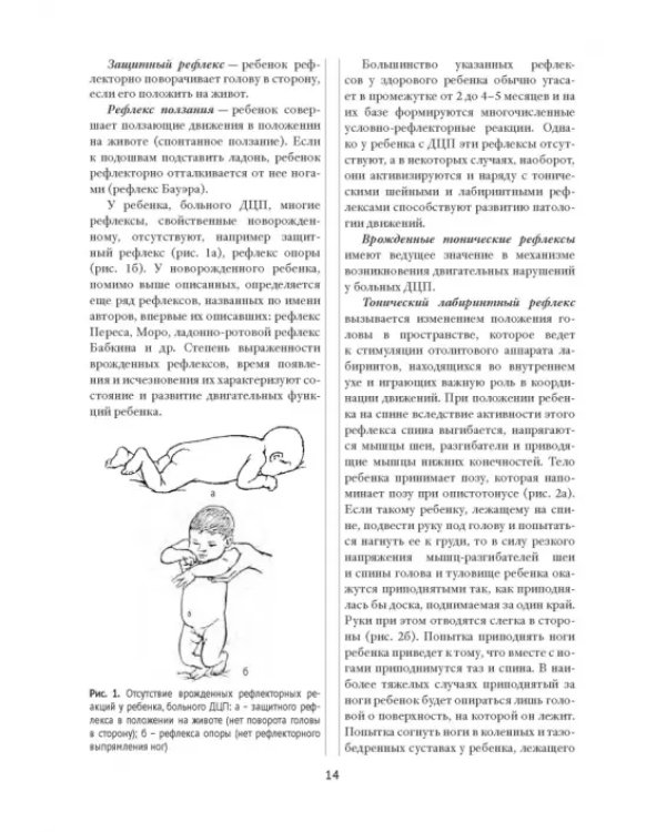 Методы физической терапии в лечении детских церебральных параличей. Методическое пособие