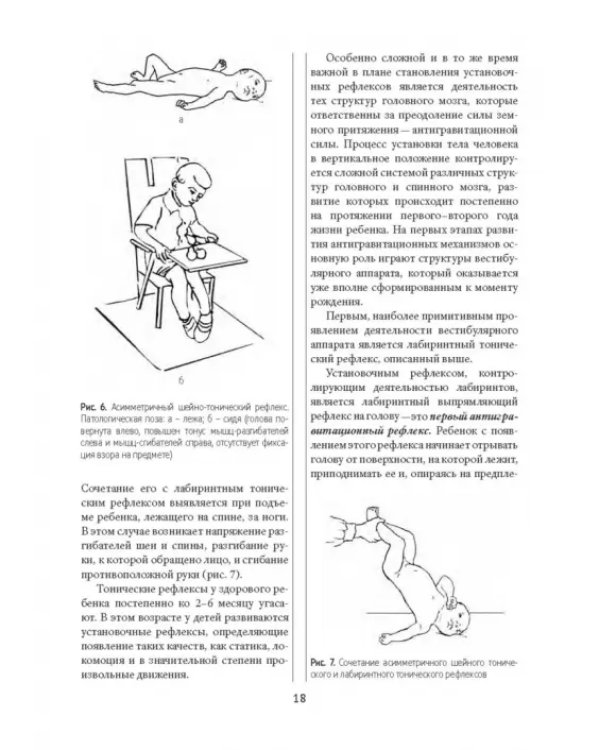 Методы физической терапии в лечении детских церебральных параличей. Методическое пособие