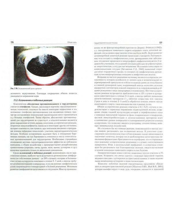 Комплексная гирудотерапия. Руководство для врачей