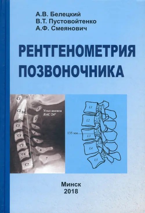 Рентгенометрия позвоночника Рентгенометрия позвоночника