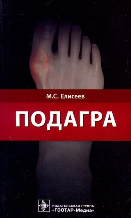 Подагра. Руководство