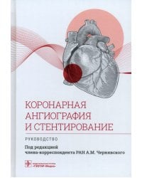Коронарная ангиография и стентирование. Руководство