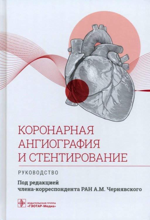 Коронарная ангиография и стентирование. Руководство