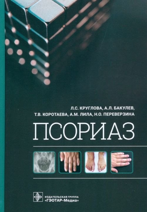 Обложка книги «Псориаз» — Круглова Лариса Сергеевна, Бакулев Андрей Леонидович, Коротаева Татьяна Викторовна, ISBN 9785970471050