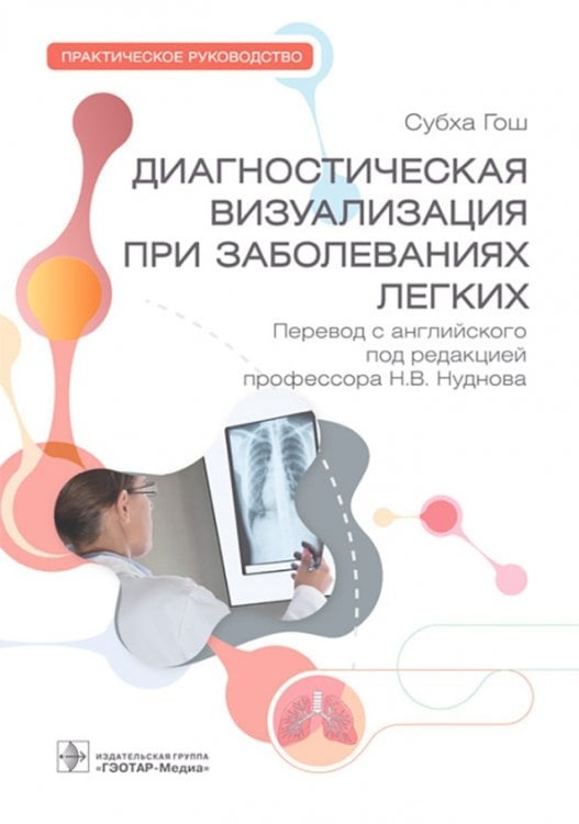 Обложка книги «Диагностическая визуализация при заболеваниях легких. Практическое руководство» — Гош Субха, ISBN 9785970473962