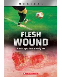Flesh Wound. A Minor Injury Takes a Deadly Turn