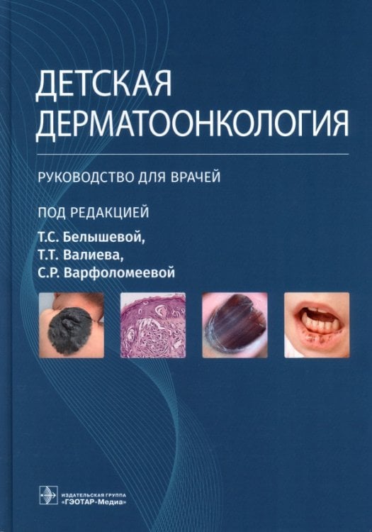 Обложка книги «Детская дерматоонкология. Руководство для врачей» — Белышева Татьяна Сергеевна, Валиев Тимур Теймуразович, Варфоломеева Светлана Рафаэлевна, ISBN 9785970476895