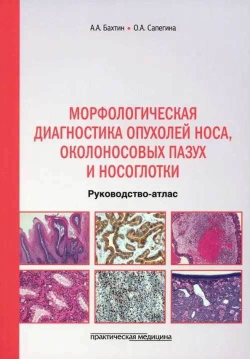Обложка книги «Морфологическая диагностика опухолей носа, околоносовых пазух и носоглотки. Руководство-атлас» — Бахтин Артур Александрович, Сапегина Ольга Александровна, ISBN 9785988117285