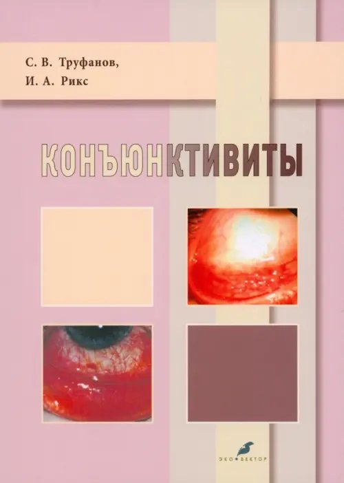 Коньюктивиты Коньюктивиты