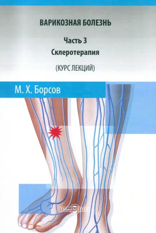 Варикозная болезнь. Часть 3. Склеротерапия. Курс лекций Варикозная болезнь. Часть 3. Склеротерапия. Курс лекций