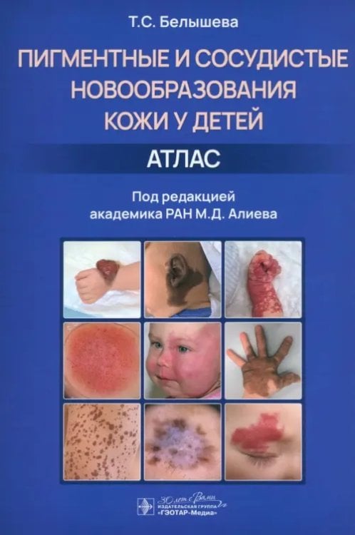 Обложка книги «Пигментные и сосудистые новообразования кожи у детей. Атлас» — Белышева Татьяна Сергеевна, ISBN 9785970478349