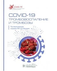 COVID-19. Тромбовоспаление и тромбозы