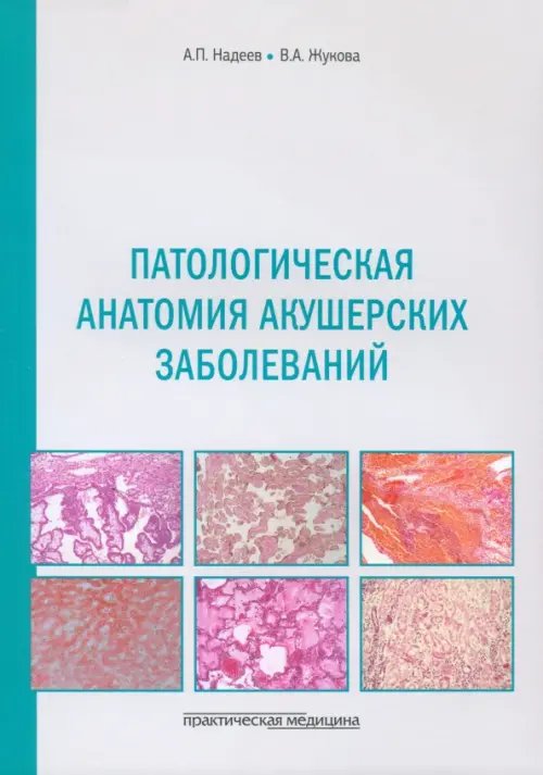 Обложка книги «Патологическая анатомия акушерских заболеваний» — Надеев Александр Петрович, Жукова Валентина Александровна, ISBN 9785988117445