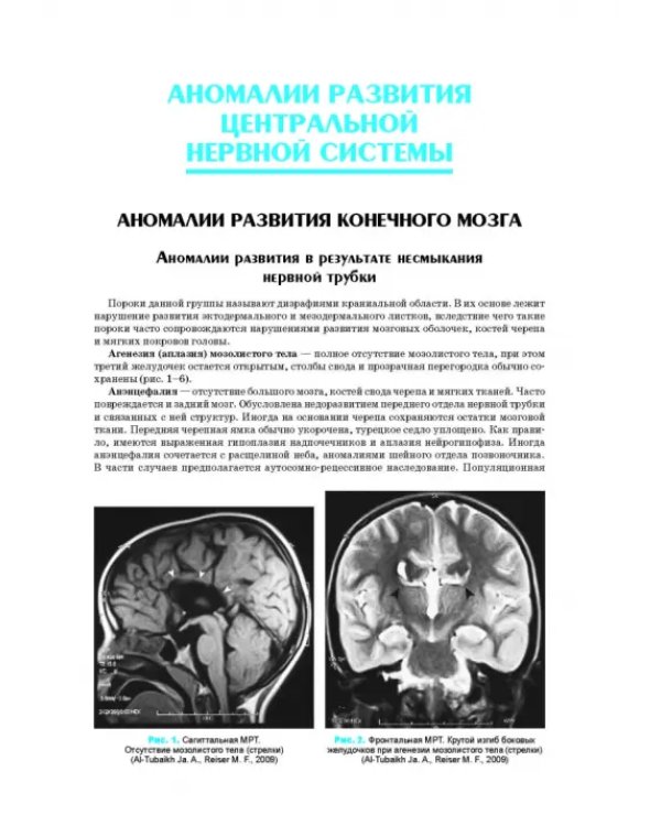 Аномалии развития нервной и сердечно-сосудистой систем. Учебное пособие для СПО