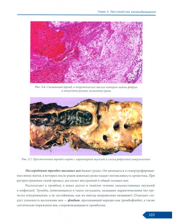 Патологическая анатомия. Общий курс. Учебник для медицинских вузов